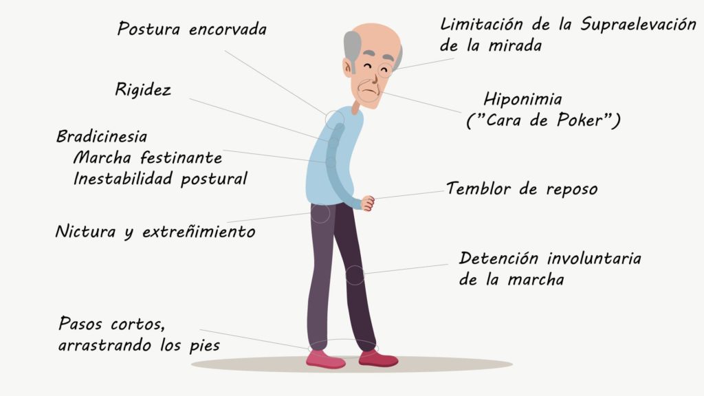 parkinson archivos - La Cruz Azul